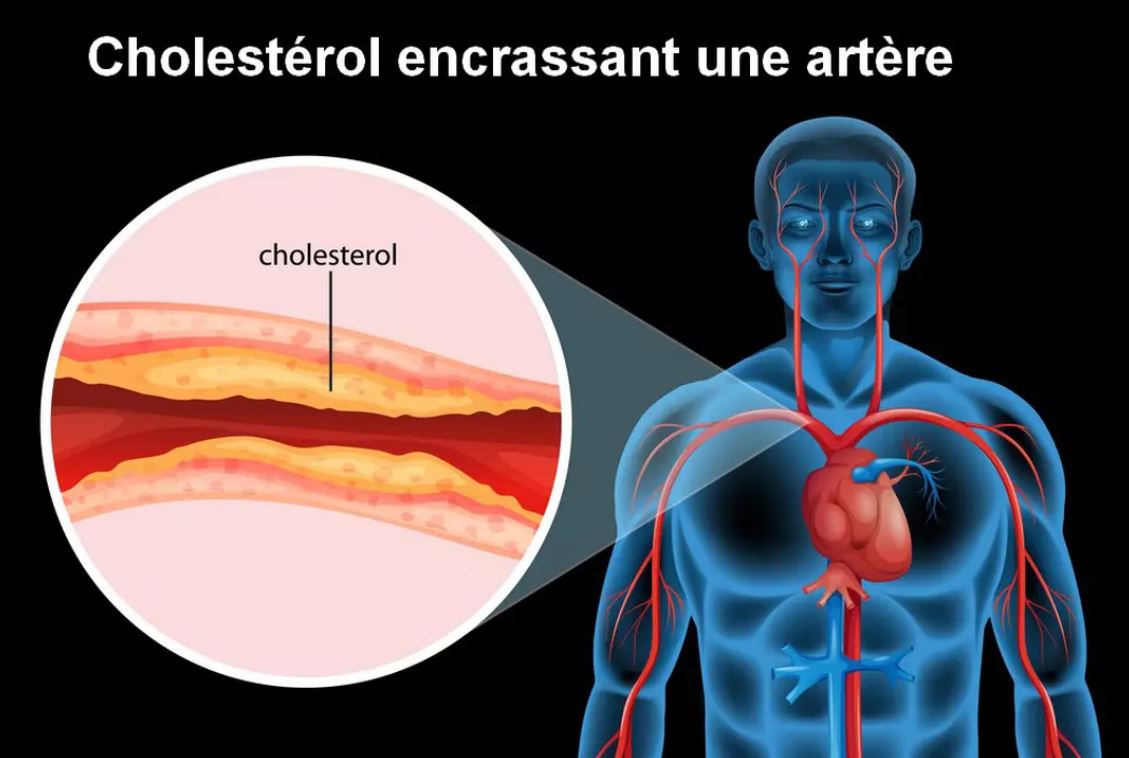 You are currently viewing Le Cholestérol de A à Z